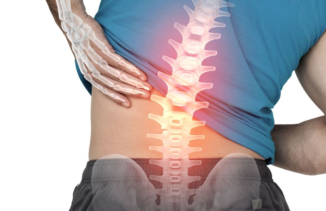 Juosmens ostechondrozės pavojus