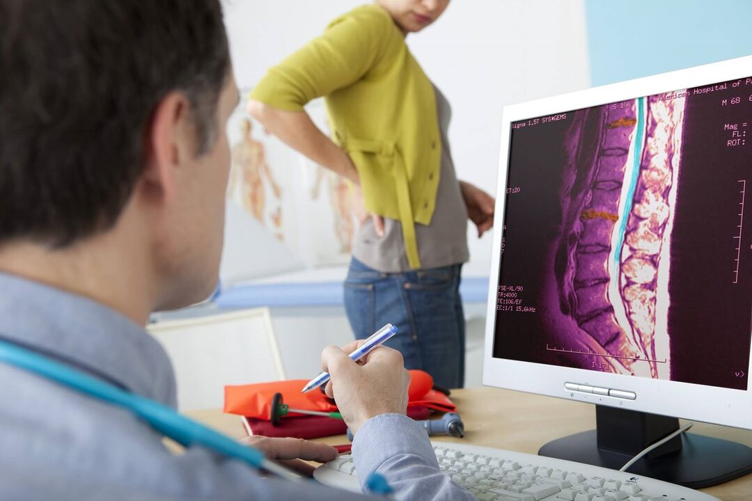 Juosmens osteochondrozės diagnozė