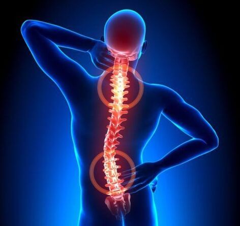 Stuburo osteochondrozė