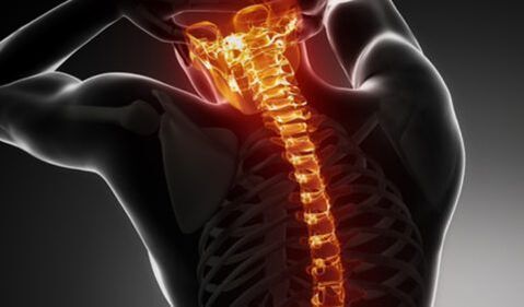 Viso stuburo osteochondrozė