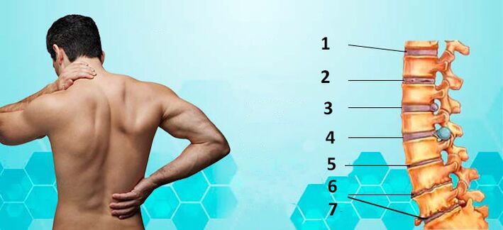 Osteochondrozės vystymosi stadijos